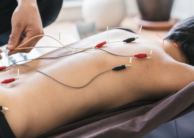 The Healing Power of Electroacupuncture in Berkeley