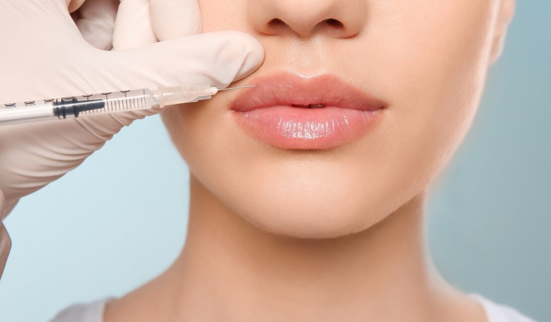 Botox-Lippen