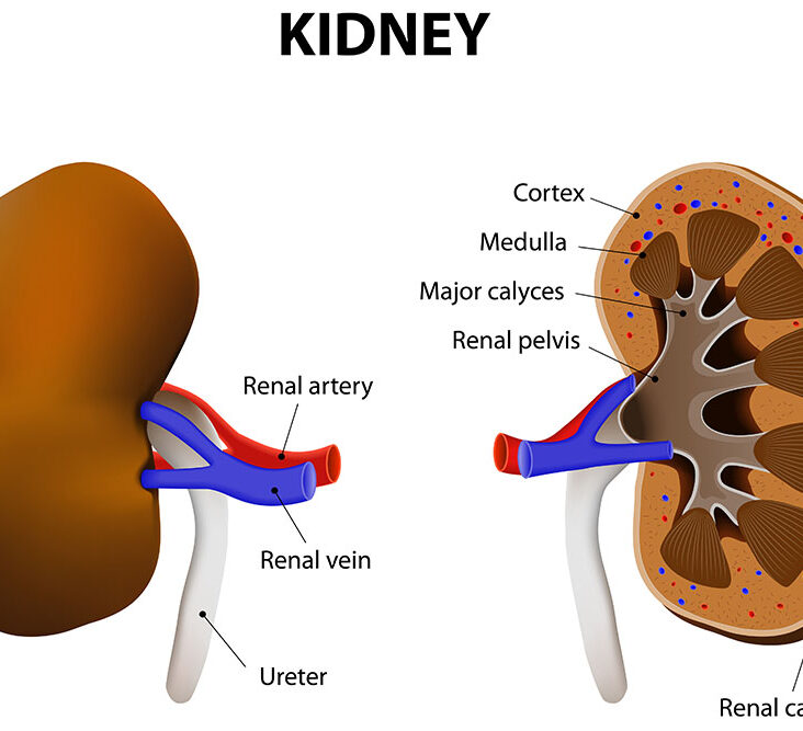 Types Of Natural Remedies; Effective For Kidney Disease