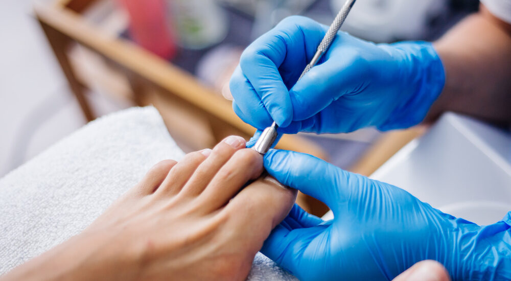 ingrown toenail removal in San Antonio