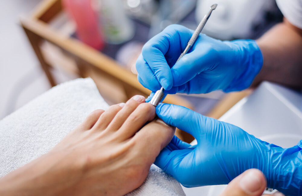 ingrown toenail removal in San Antonio