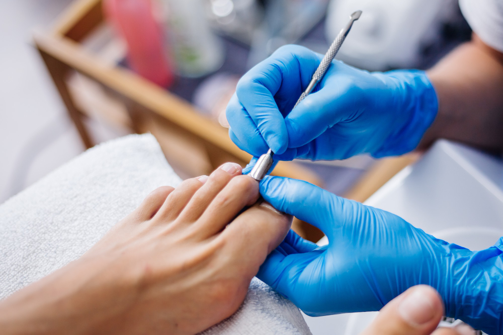 ingrown toenail removal in San Antonio