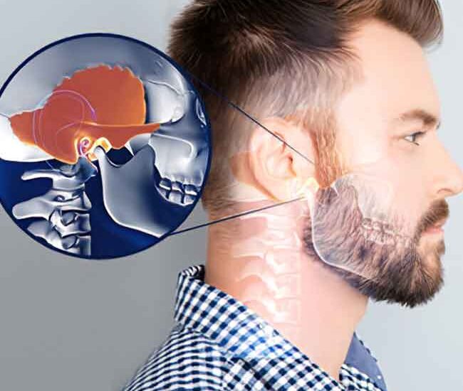 TMJ Treatment in Surrey