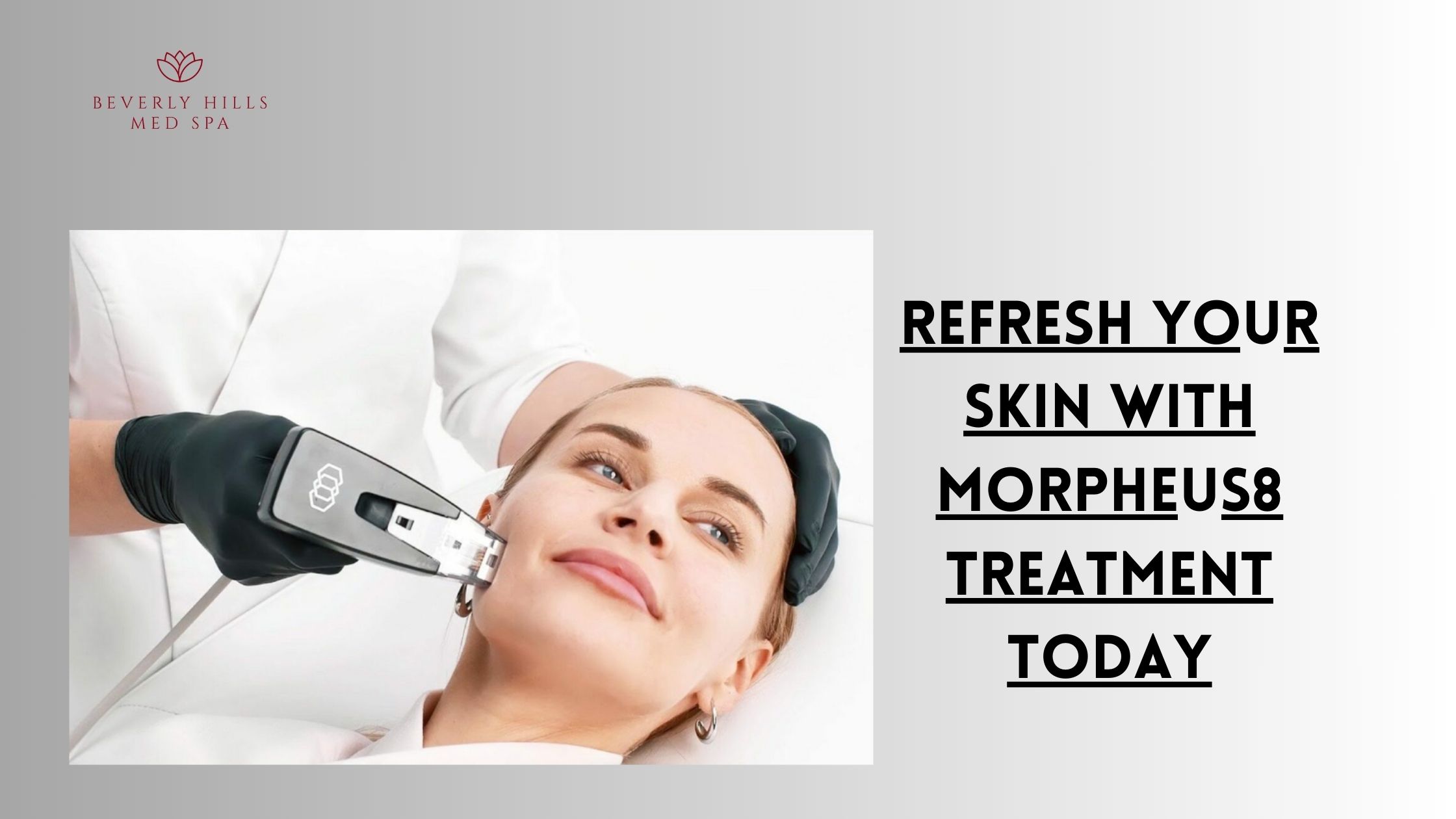 morpheus8 treatment