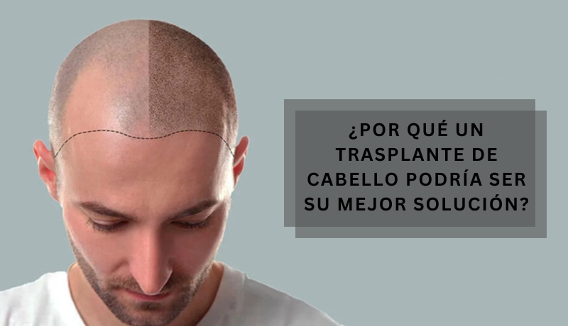 Trasplante de cabello