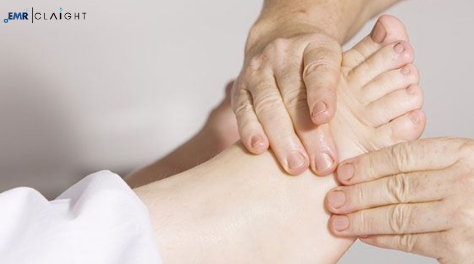 Global Peripheral Neuropathy Treatment Market