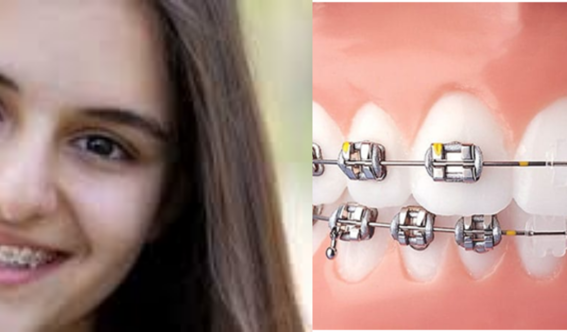 dental implants in jaipur