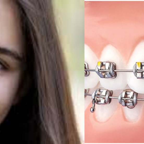 dental implants in jaipur