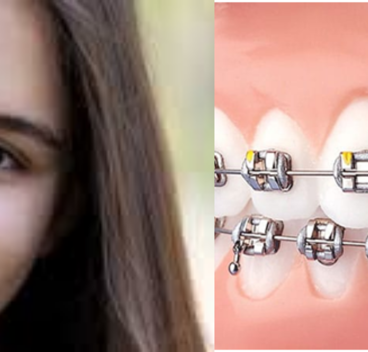 dental implants in jaipur