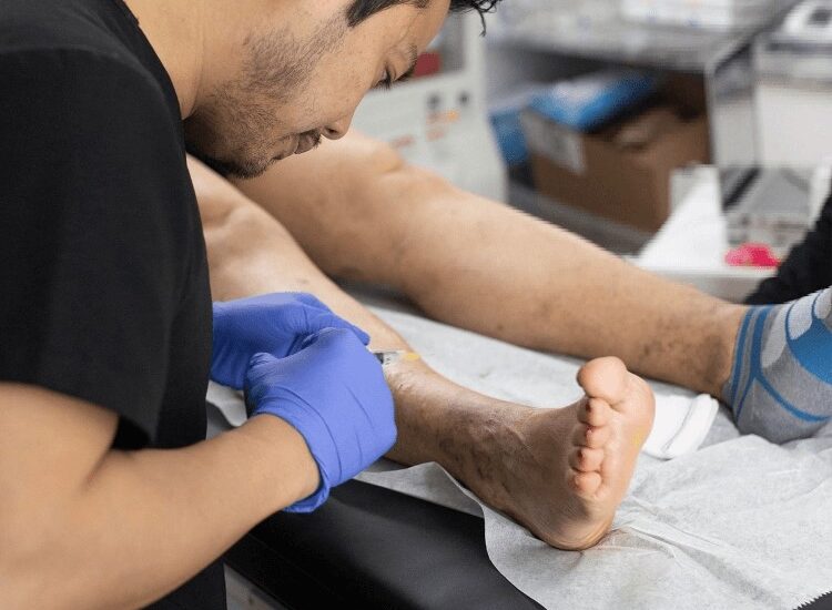 What Kind of Specialist Treats Varicose Veins