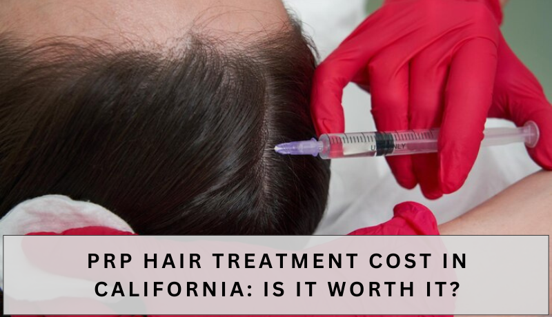 prp hair treatment cost California