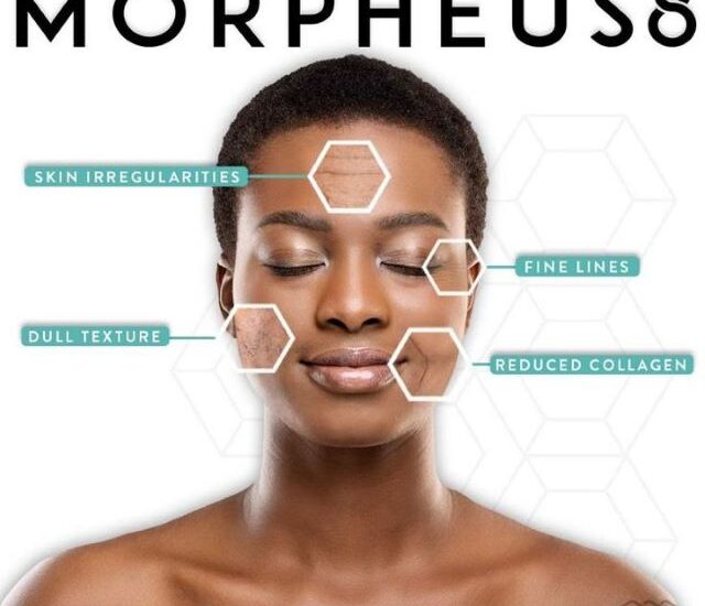 Morpheus8 Treatment Cost