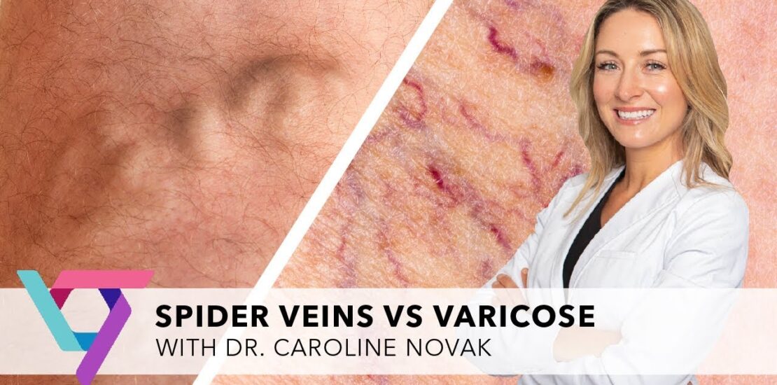 when to see a vascular doctor