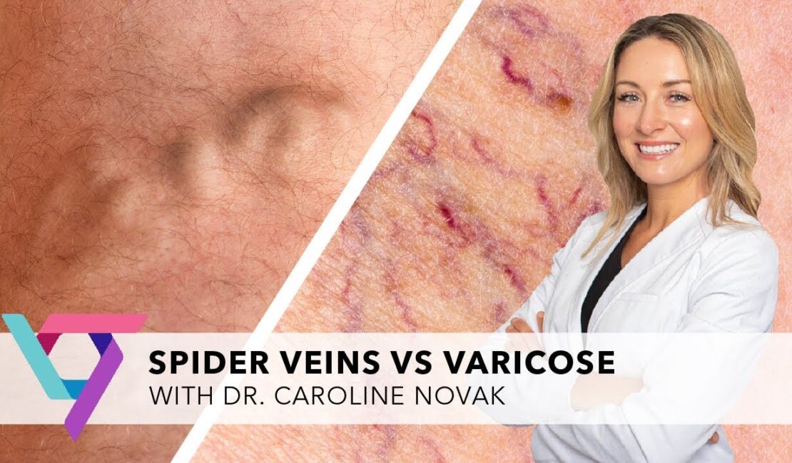 when to see a vascular doctor