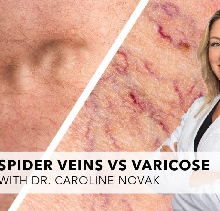 when to see a vascular doctor