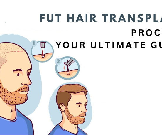 fut hair transplantation