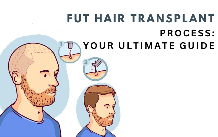 fut hair transplantation