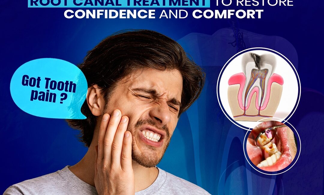 Painless Root Canal Treatment in Dwarka, Delhi