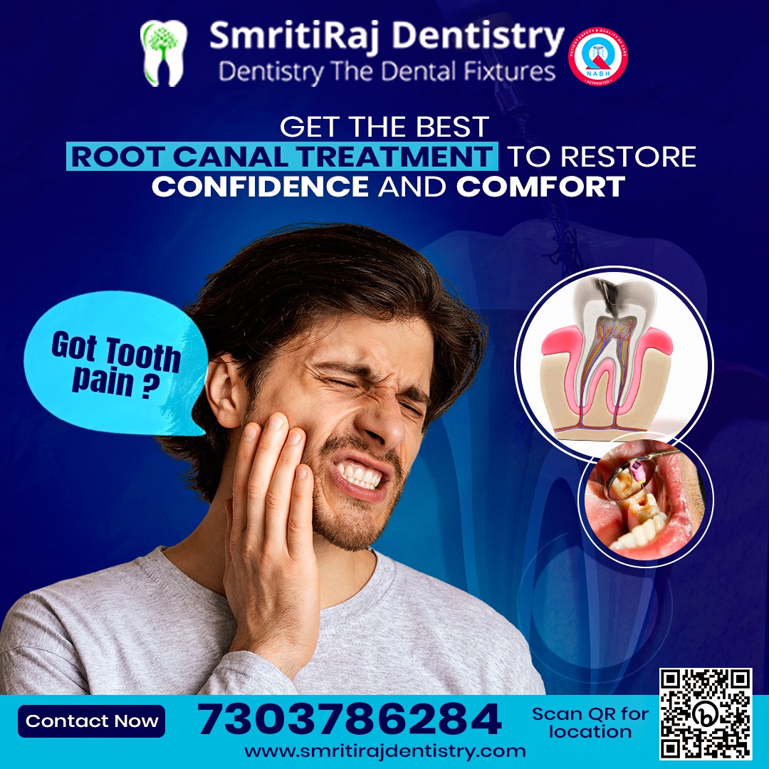 Painless Root Canal Treatment in Dwarka, Delhi