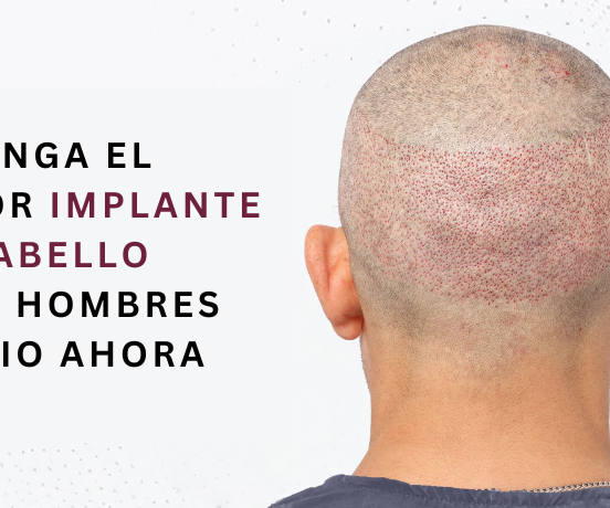 implante de cabello para hombres precio