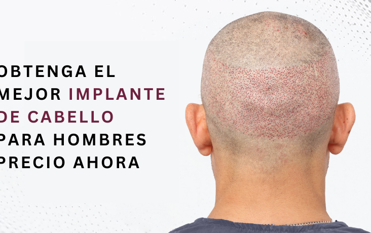 implante de cabello para hombres precio