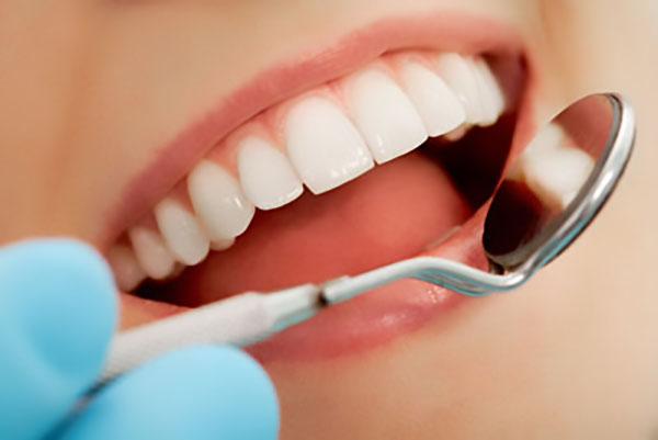 professional teeth whitening near me