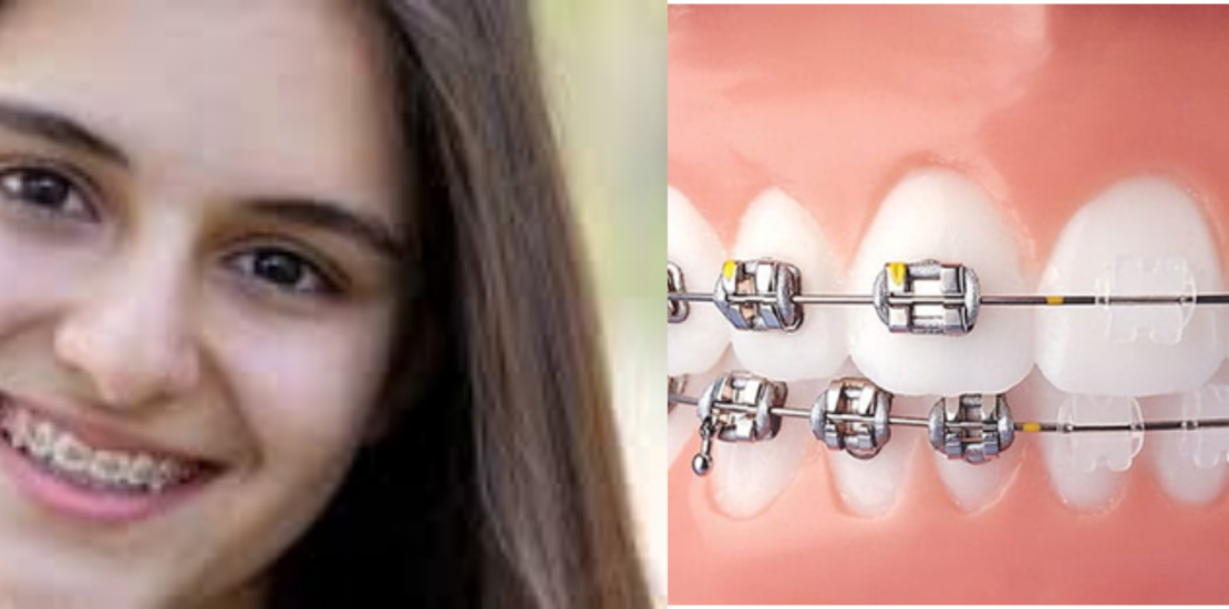 smile dental clinic jaipur
