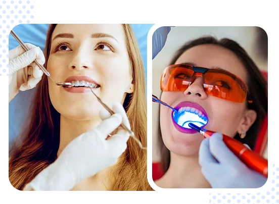 teeth whitening dentist