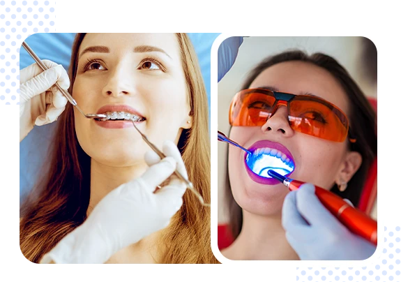 teeth whitening dentist