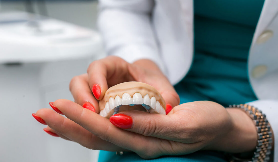 same day veneers near me