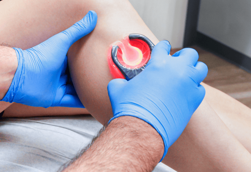 How can I get rid of varicose veins without surgery?