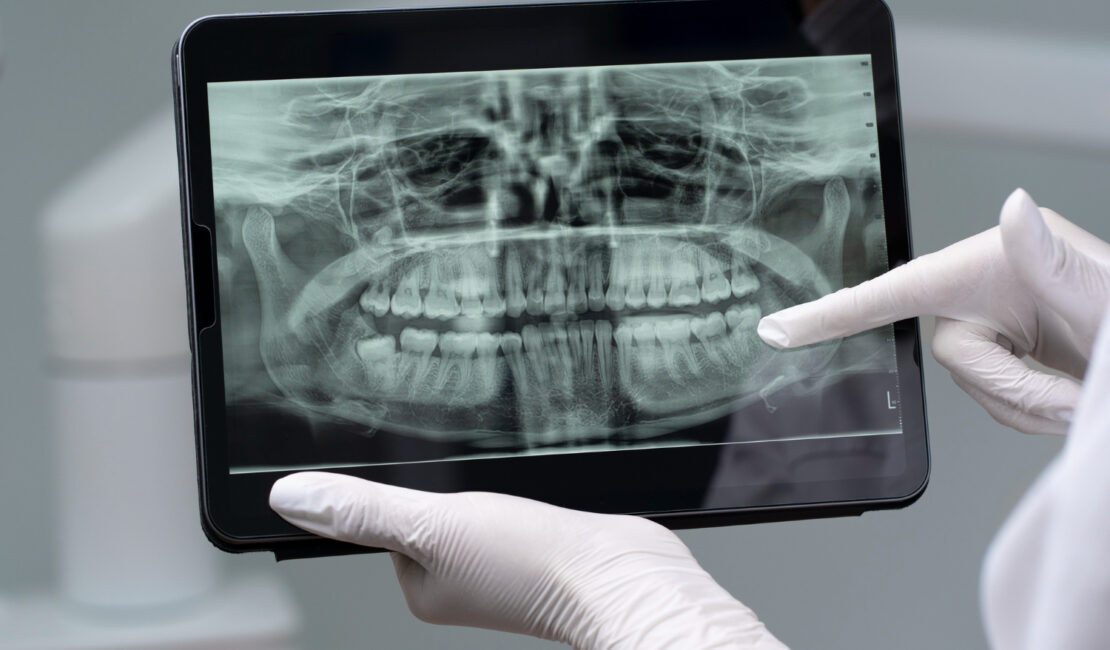 Dental Radiology in Dwarka