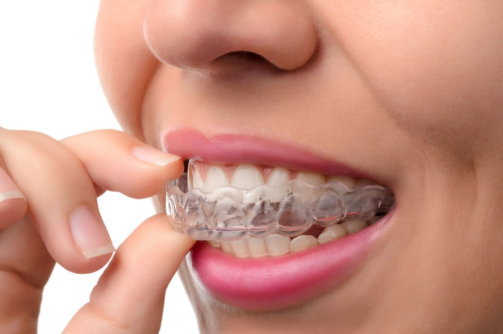 Bruxism Treatment