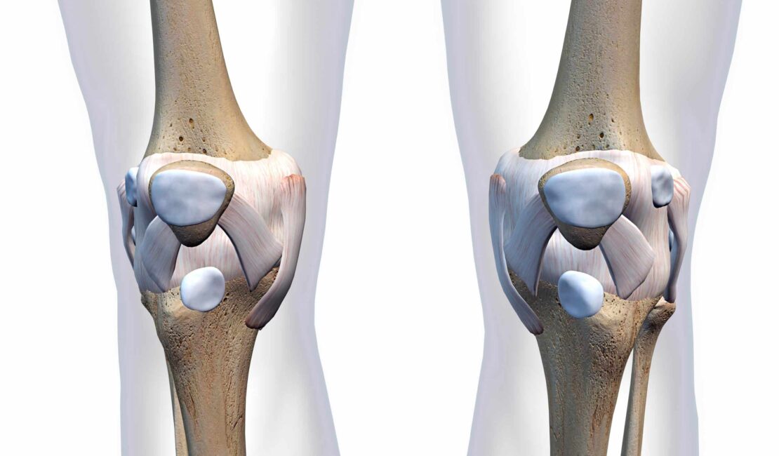 knee management specialist