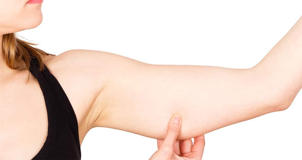 Arm Liposuction