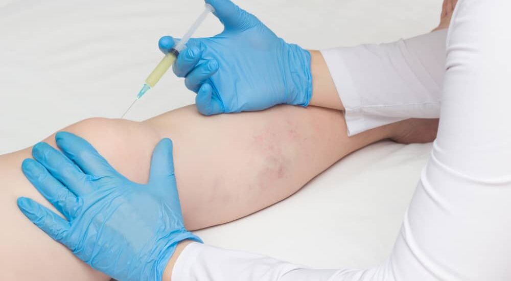 Knee Pain doctor nyc