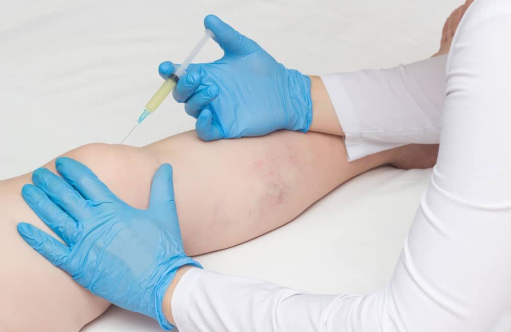 Knee Pain doctor nyc