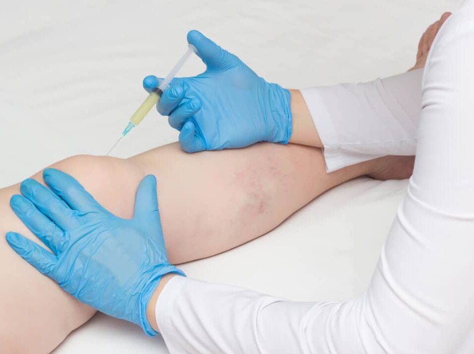 Knee Pain doctor nyc