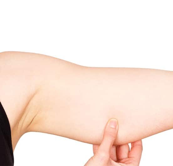 Arm Liposuction