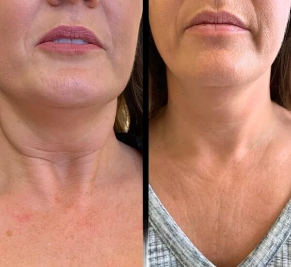 Best Plastic Surgeons in dubai