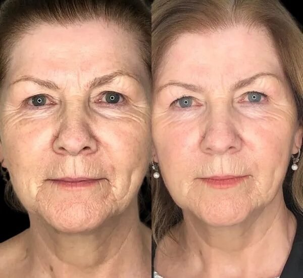 Best Plastic Surgeon in dubai