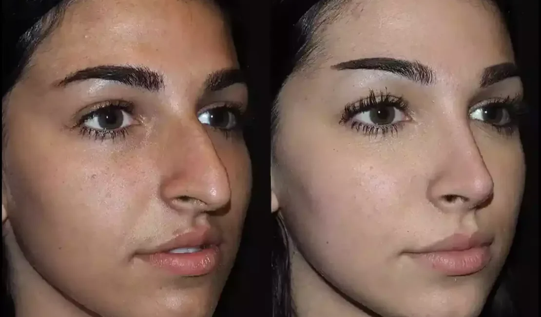 Who is the Best Septoplasty Surgeon in Dubai Today?