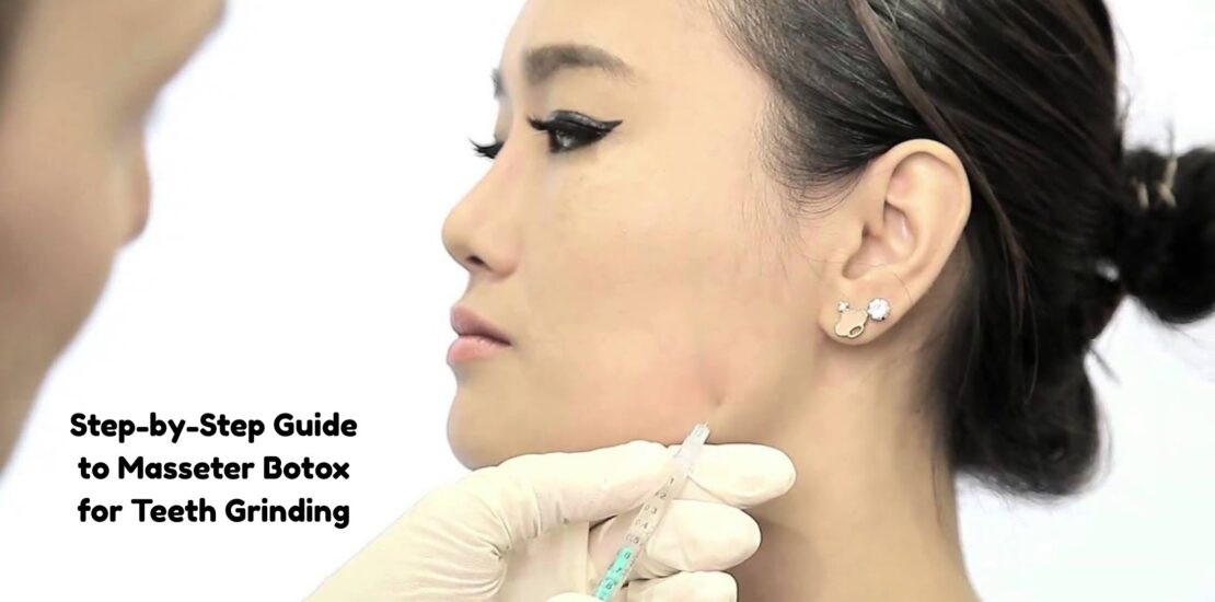 masseter botox for teeth grinding