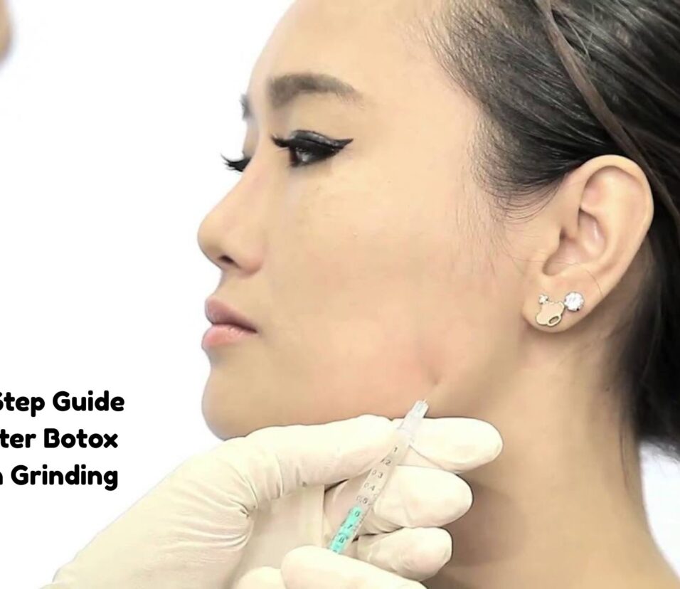 masseter botox for teeth grinding