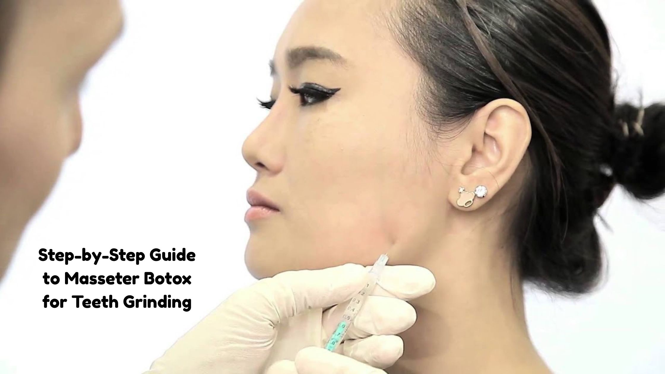 masseter botox for teeth grinding