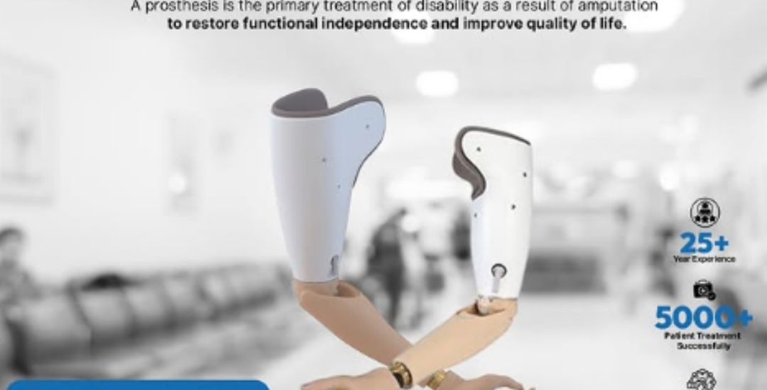 Upper Limb Prosthetics
