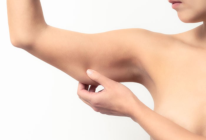 arm lipo before and after