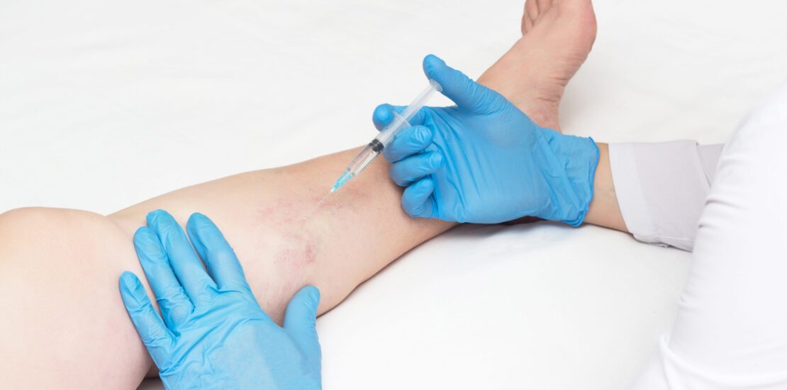 what kind of doctor is a vein specialist