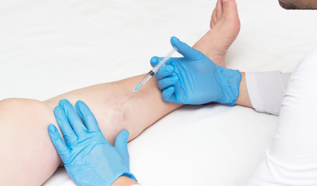 what kind of doctor is a vein specialist