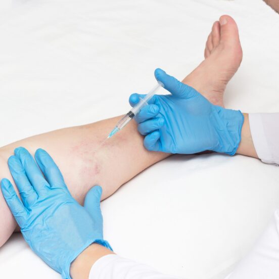 what kind of doctor is a vein specialist
